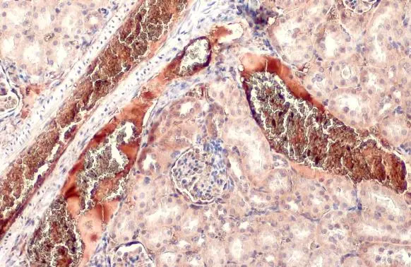 TGF beta 3 antibody detects secreted TGF beta 3 protein by immunohistochemical analysis. Sample: Paraffin-embedded mouse kidney. TGF beta 3 stained by TGF beta 3 antibody (GTX129091) diluted at 1:500. Antigen Retrieval: Citrate buffer, pH 6.0, 15 min