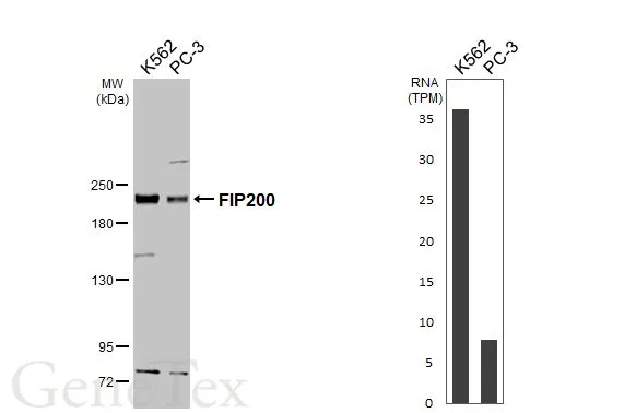 Various whole cell extracts (30 μg) were separated by 5% SDS-PAGE, and the membrane was blotted with FIP200 antibody (GTX129093) diluted at 1:1000. The HRP-conjugated anti-rabbit IgG antibody (GTX213110-01) was used to detect the primary antibody. Corresponding RNA expression data for the same cell lines are based on Human Protein Atlas program. Various whole cell extracts (30 μg) were separated by 5% SDS-PAGE, and the membrane was blotted with FIP200 antibody (GTX129093) diluted at 1:1000. The HRP-conjugated anti-rabbit IgG antibody (GTX213110-01) was used to detect the primary antibody. Corresponding RNA expression data for the same cell lines are based on Human Protein Atlas program.