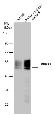 Jurkat whole cell and nuclear extracts (30 μg) were separated by 10% SDS-PAGE, and the membrane was blotted with RUNX1 antibody (GTX129100) diluted at 1:1000.