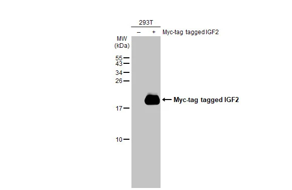 Non-transfected (–) and transfected (+) 293T whole cell extracts (30 μg) were separated by 7.5% SDS-PAGE, and the membrane was blotted with IGF2 antibody (GTX129110) diluted at 1:1000. The HRP-conjugated anti-rabbit IgG antibody (GTX213110-01) was used to detect the primary antibody.