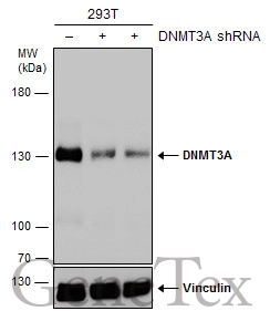 Whole cell extract (30 ug) was separated by 7.5% SDS-PAGE,and the membrane was blotted with DNMT3A antibody (GTX129125) diluted at 1:1000. The HRP-conjugated anti-rabbit IgG antibody (GTX213110-01) was used to detect the primary antibody.