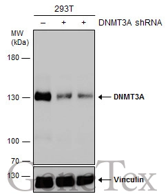Non-transfected (–) and transfected (+) 293T whole cell extracts (30 μg) were separated by 5% SDS-PAGE, and the membrane was blotted with DNMT3A antibody (GTX129125) diluted at 1:500. The HRP-conjugated anti-rabbit IgG antibody (GTX213110-01) was used to detect the primary antibody. Non-transfected (–) and transfected (+) 293T whole cell extracts (30 μg) were separated by 5% SDS-PAGE, and the membrane was blotted with DNMT3A antibody (GTX129125) diluted at 1:500. The HRP-conjugated anti-rabbit IgG antibody (GTX213110-01) was used to detect the primary antibody.