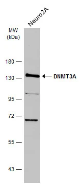 Whole cell extract (30 μg) was separated by 7.5% SDS-PAGE, and the membrane was blotted with DNMT3A antibody (GTX129125) diluted at 1:1000. The HRP-conjugated anti-rabbit IgG antibody (GTX213110-01) was used to detect the primary antibody. Whole cell extract (30 μg) was separated by 7.5% SDS-PAGE, and the membrane was blotted with DNMT3A antibody (GTX129125) diluted at 1:1000. The HRP-conjugated anti-rabbit IgG antibody (GTX213110-01) was used to detect the primary antibody.