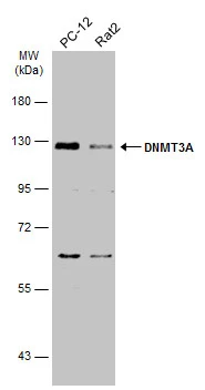 Various whole cell extracts (30 μg) were separated by 7.5% SDS-PAGE, and the membrane was blotted with DNMT3A antibody (GTX129125) diluted at 1:1000. The HRP-conjugated anti-rabbit IgG antibody (GTX213110-01) was used to detect the primary antibody. Various whole cell extracts (30 μg) were separated by 7.5% SDS-PAGE, and the membrane was blotted with DNMT3A antibody (GTX129125) diluted at 1:1000. The HRP-conjugated anti-rabbit IgG antibody (GTX213110-01) was used to detect the primary antibody.