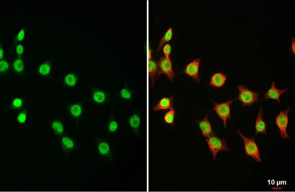 DNMT3A antibody detects DNMT3A protein at nucleus by immunofluorescent analysis. Sample: 293T cells were fixed in 4% paraformaldehyde at RT for 15 min. Green: DNMT3A stained by DNMT3A antibody (GTX129125) diluted at 1:1000. Red: alpha Tubulin, a cytoskeleton marker, stained by alpha Tubulin antibody [GT114] (GTX628802) diluted at 1:1000.