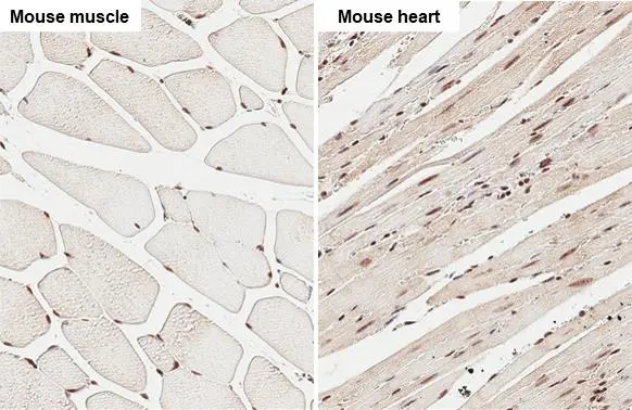 DNMT3A antibody detects DNMT3A protein at nucleus by immunohistochemical analysis. Sample: Paraffin-embedded mouse tissue. DNMT3A stained by DNMT3A antibody (GTX129125) diluted at 1:500. Antigen Retrieval: Citrate buffer, pH 6.0, 15 min DNMT3A antibody detects DNMT3A protein at nucleus by immunohistochemical analysis. Sample: Paraffin-embedded mouse tissue. DNMT3A stained by DNMT3A antibody (GTX129125) diluted at 1:500. Antigen Retrieval: Citrate buffer, pH 6.0, 15 min