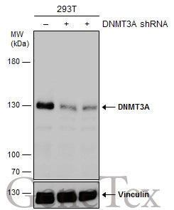 Non-transfected (–) and transfected (+) 293T whole cell extracts (30 μg) were separated by 5% SDS-PAGE, and the membrane was blotted with DNMT3A antibody (GTX129126) diluted at 1:3000. Non-transfected (–) and transfected (+) 293T whole cell extracts (30 μg) were separated by 5% SDS-PAGE, and the membrane was blotted with DNMT3A antibody (GTX129126) diluted at 1:3000.