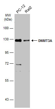 Various whole cell extracts (30 μg) were separated by 7.5% SDS-PAGE, and the membrane was blotted with DNMT3A antibody (GTX129126) diluted at 1:1000. The HRP-conjugated anti-rabbit IgG antibody (GTX213110-01) was used to detect the primary antibody. Various whole cell extracts (30 μg) were separated by 7.5% SDS-PAGE, and the membrane was blotted with DNMT3A antibody (GTX129126) diluted at 1:1000. The HRP-conjugated anti-rabbit IgG antibody (GTX213110-01) was used to detect the primary antibody.