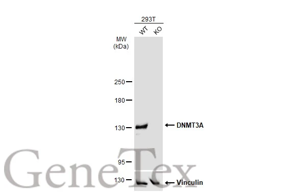 Immunoprecipitation of DNMT3A protein from 293T whole cell extracts using 5 ug of DNMT3A antibody (GTX129126) or DNMT3A antibody (GTX129125).