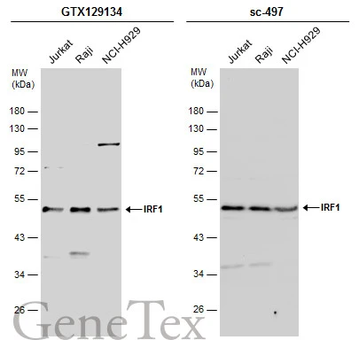 Various whole cell extracts (30 μg) were separated by 10% SDS-PAGE, and the membranes were blotted with IRF1 antibody (GTX129134) diluted at 1:1000 and competitor's antibody (sc-497) diluted at 1:100. The HRP-conjugated anti-rabbit IgG antibody (GTX213110-01) was used to detect the primary antibody. *The competitor is not affiliated with GeneTex and does not endorse this product.