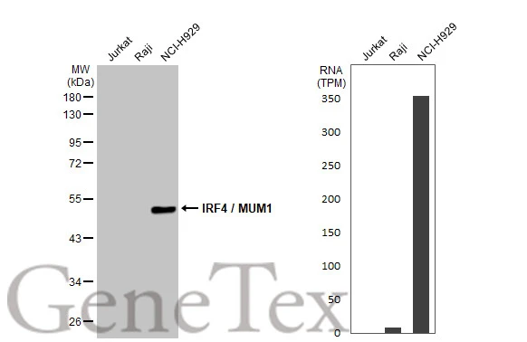 Various whole cell extracts (30 μg) were separated by 10% SDS-PAGE, and the membrane was blotted with IRF4 / MUM1 antibody (GTX129135) diluted at 1:1000. The HRP-conjugated anti-rabbit IgG antibody (GTX213110-01) was used to detect the primary antibody. Corresponding RNA expression data for the same cell lines are based on Human Protein Atlas program.