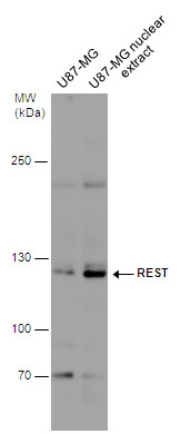 U87-MG whole cell and nuclear extracts (30 ug) were separated by 5% SDS-PAGE,and the membrane was blotted with REST antibody (GTX129144) diluted at 1:500.