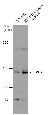 U87-MG whole cell and nuclear extracts (30 μg) were separated by 5% SDS-PAGE, and the membrane was blotted with REST antibody (GTX129144) diluted at 1:500.
