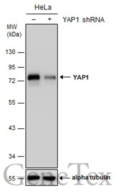 Anti-YAP1 antibody (GTX129151) | GeneTex