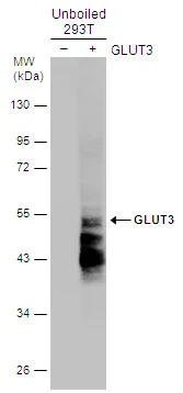 Unboiled non-transfected (–) and transfected (+) 293T whole cell extracts (30 μg) were separated by 10% SDS-PAGE, and the membrane was blotted with GLUT3 antibody (GTX129175) diluted at 1:2000.