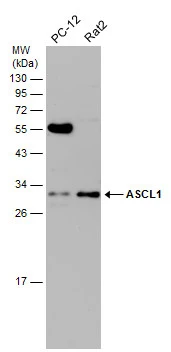 Various whole cell extracts (30 μg) were separated by 12% SDS-PAGE, and the membrane was blotted with ASCL1 antibody (GTX129189) diluted at 1:1000.