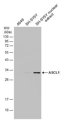 Various whole cell and SH-SY5Y nuclear extracts (30 μg) were separated by 12% SDS-PAGE, and the membrane was blotted with ASCL1 antibody (GTX129189) diluted at 1:1000.