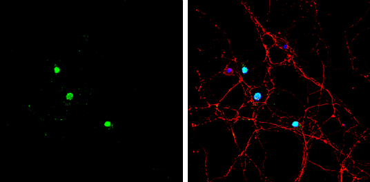 ASCL1 antibody detects ASCL1 protein by immunofluorescent analysis. Sample: DIV9 rat E18 primary hippocampal neuron cells were fixed in 4% paraformaldehyde at RT for 15 min. Green: ASCL1 stained by ASCL1 antibody (GTX129189) diluted at 1:500. Red: beta Tubulin 3/ Tuj1, stained by beta Tubulin 3/ Tuj1 antibody [GT11710] (GTX631836) diluted at 1:500. Blue: Fluoroshield with DAPI (GTX30920).