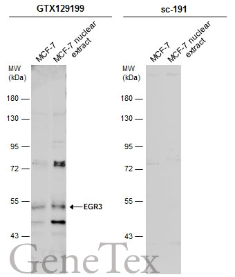 MCF-7 whole cell and nuclear extracts (30 μg) were separated by 7.5% SDS-PAGE, and the membranes were blotted with EGR3 antibody (GTX129199) diluted at 1:500 and competitor's antibody (sc-191) diluted at 1:1000. The HRP-conjugated anti-rabbit IgG antibody (GTX213110-01) was used to detect the primary antibody, and the signal was developed with Trident ECL plus-Enhanced.
