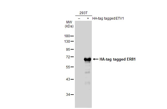 Non-transfected (–) and transfected (+) 293T whole cell extracts (30 μg) were separated by 10% SDS-PAGE, and the membrane was blotted with ER81 antibody (GTX129202) diluted at 1:5000. The HRP-conjugated anti-rabbit IgG antibody (GTX213110-01) was used to detect the primary antibody.
