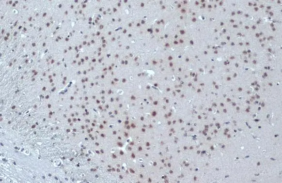 ER81 antibody detects ER81 protein at nucleus by immunohistochemical analysis. Sample: Paraffin-embedded mouse brain. ER81 stained by ER81 antibody (GTX129202) diluted at 1:500. Antigen Retrieval: Citrate buffer, pH 6.0, 15 min