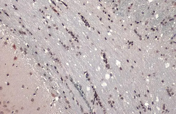 ER81 antibody detects ER81 protein at nucleus by immunohistochemical analysis. Sample: Paraffin-embedded rat brain. ER81 stained by ER81 antibody (GTX129202) diluted at 1:500. Antigen Retrieval: Citrate buffer, pH 6.0, 15 min