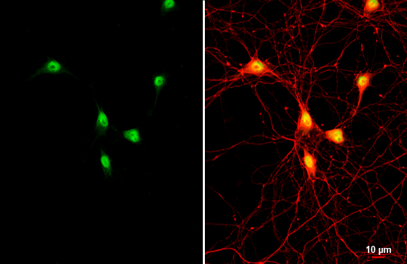 ER81 antibody detects ER81 protein by immunofluorescent analysis. Sample: DIV9 rat hippocampal neuron and Glia cell cells were fixed in 4% paraformaldehyde at RT for 15 min. Green: ER81 stained by ER81 antibody (GTX129202) diluted at 1:250. Red: Tau, an axon marker, stained by Tau antibody [GT287] (GTX634809) diluted at 1:500.