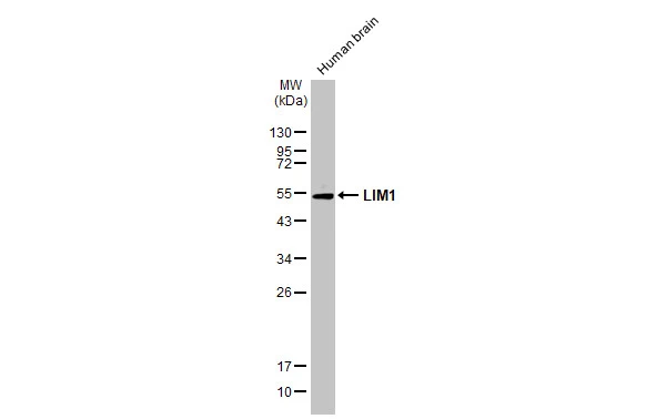 LIM1 antibody