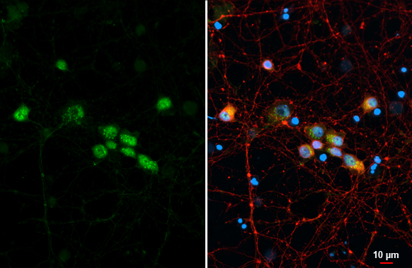 LIM1 antibody detects LIM1 protein at cytoplasm and nucleus by immunofluorescent analysis. Sample: DIV9 rat E18 primary cortical neuron cells were fixed in 4% paraformaldehyde at RT for 15 min. Green: LIM1 stained by LIM1 antibody (GTX129215) diluted at 1:250. Red: Tau, an axon marker, stained by Tau antibody [GT287] (GTX634809) diluted at 1:500. Blue: Fluoroshield with DAPI (GTX30920).