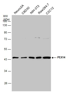 Various whole cell extracts (30 μg) were separated by 10% SDS-PAGE, and the membrane was blotted with PEX14 antibody (GTX129230) diluted at 1:1000. The HRP-conjugated anti-rabbit IgG antibody (GTX213110-01) was used to detect the primary antibody.