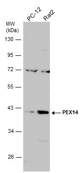 Various whole cell extracts (30 μg) were separated by 10% SDS-PAGE, and the membrane was blotted with PEX14 antibody (GTX129230) diluted at 1:1000. The HRP-conjugated anti-rabbit IgG antibody (GTX213110-01) was used to detect the primary antibody.