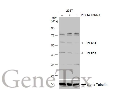 Non-transfected (–) and transfected (+) 293T whole cell extracts (30 μg) were separated by 10% SDS-PAGE, and the membrane was blotted with PEX14 antibody (GTX129230) diluted at 1:500. The HRP-conjugated anti-rabbit IgG antibody (GTX213110-01) was used to detect the primary antibody.