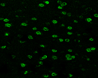 SOX3 antibody detects SOX3 protein at nucleus in rat brain by immunohistochemical analysis. Sample: Paraffin-embedded rat brain. Green: SOX3 antibody (GTX129235) diluted at 1:200. The signal was developed using goat anti-rabbit IgG antibody (Dylight488) (GTX213110-04).
Antigen Retrieval: Citrate buffer, pH 6.0, 15 min SOX3 antibody detects SOX3 protein at nucleus in rat brain by immunohistochemical analysis. Sample: Paraffin-embedded rat brain. Green: SOX3 antibody (GTX129235) diluted at 1:200. The signal was developed using goat anti-rabbit IgG antibody (Dylight488) (GTX213110-04).
Antigen Retrieval: Citrate buffer, pH 6.0, 15 min