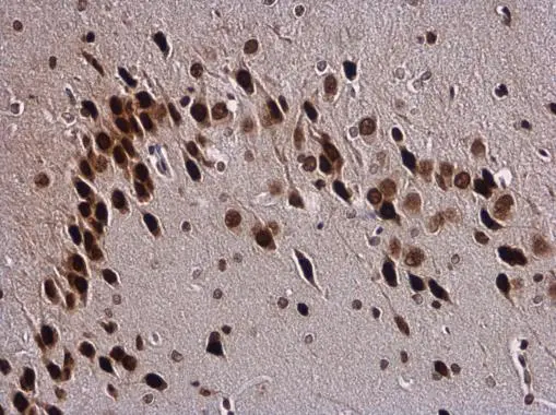 SOX3 antibody detects SOX3 protein at nucleus in mouse brain by immunohistochemical analysis. Sample: Paraffin-embedded mouse brain. SOX3 antibody (GTX129235) diluted at 1:500.
Antigen Retrieval: Citrate buffer, pH 6.0, 15 min SOX3 antibody detects SOX3 protein at nucleus in mouse brain by immunohistochemical analysis. Sample: Paraffin-embedded mouse brain. SOX3 antibody (GTX129235) diluted at 1:500.
Antigen Retrieval: Citrate buffer, pH 6.0, 15 min