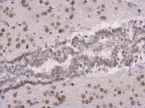 SOX3 antibody detects SOX3 protein at nucleus in mouse brain by immunohistochemical analysis. Sample: Paraffin-embedded mouse brain. SOX3 antibody (GTX129235) diluted at 1:500.
Antigen Retrieval: Citrate buffer, pH 6.0, 15 min SOX3 antibody detects SOX3 protein at nucleus in mouse brain by immunohistochemical analysis. Sample: Paraffin-embedded mouse brain. SOX3 antibody (GTX129235) diluted at 1:500.
Antigen Retrieval: Citrate buffer, pH 6.0, 15 min