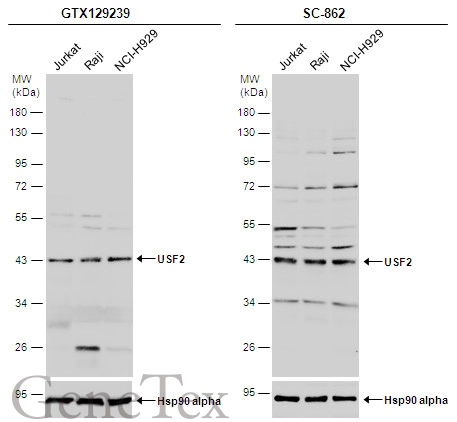 Various whole cell extracts (30 μg) were separated by 10% SDS-PAGE, and the membranes were blotted with USF2 antibody (GTX129239) diluted at 1:500 and competitor's antibody (SC-862) diluted by 1:200.