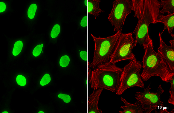 USF2 antibody detects USF2 protein at nucleus by immunofluorescent analysis. Sample: HeLa cells were fixed in 4% paraformaldehyde at RT for 15 min. Green: USF2 stained by USF2 antibody (GTX129239) diluted at 1:500. Red: phalloidin, a cytoskeleton marker, diluted at 1:100. Scale bar= 10 μm.