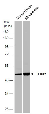 Various tissue extracts (50 μg) were separated by 10% SDS-PAGE, and the membranes were blotted with LHX2 antibody (GTX129241) diluted at 1:10000 (left panel) and 1:5000 (right panel). The HRP-conjugated anti-rabbit IgG antibody (GTX213110-01) was used to detect the primary antibody.