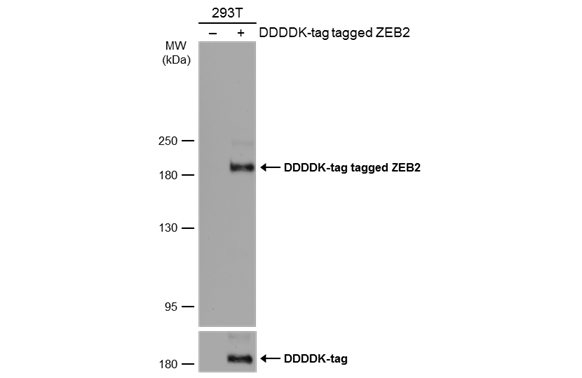 Non-transfected (–) and transfected (+) 293T whole cell extracts (30 μg) were separated by 5% SDS-PAGE, and the membrane was blotted with ZEB2 antibody (GTX129243) diluted at 1:1000. The HRP-conjugated anti-rabbit IgG antibody (GTX213110-01) was used to detect the primary antibody.
