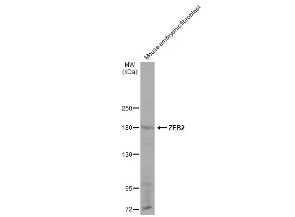 Mouse tissue extract (30 μg) were separated by 5% SDS-PAGE, and the membrane was blotted with ZEB2 antibody (GTX129243) diluted at 1:1000. The HRP-conjugated anti-rabbit IgG antibody (GTX213110-01) was used to detect the primary antibody, and the signal was developed with Trident ECL plus-Enhanced.