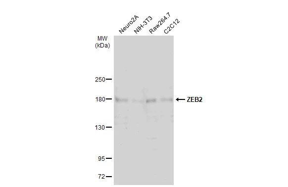 Various whole cell extracts (30 μg) were separated by 5% SDS-PAGE, and the membrane was blotted with ZEB2 antibody (GTX129243) diluted at 1:500. The HRP-conjugated anti-rabbit IgG antibody (GTX213110-01) was used to detect the primary antibody, and the signal was developed with Trident ECL plus-Enhanced.