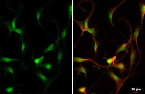 ZEB2 antibody detects ZEB2 protein at nucleus by immunofluorescent analysis. Sample: U87-MG cells were fixed in 4% paraformaldehyde at RT for 15 min. Green: ZEB2 stained by ZEB2 antibody (GTX129243) diluted at 1:500. Red: alpha Tubulin, a cytoskeleton marker, stained by alpha Tubulin antibody [GT114] (GTX628802) diluted at 1:1000.
