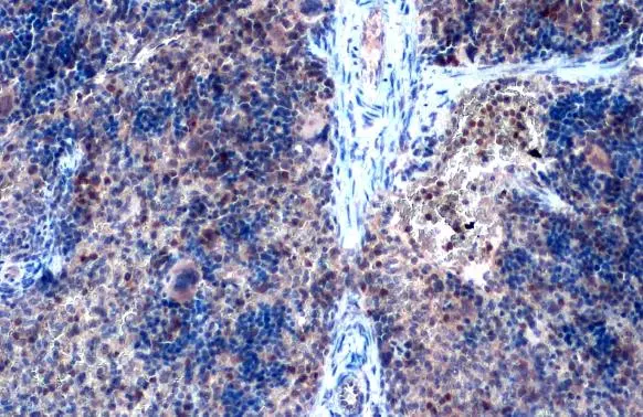 ZEB2 antibody detects ZEB2 protein at nucleus by immunohistochemical analysis. Sample: Paraffin-embedded mouse spleen. ZEB2 stained by ZEB2 antibody (GTX129243) diluted at 1:1000. Antigen Retrieval: Citrate buffer, pH 6.0, 15 min
