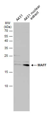 A431 whole cell and nuclear extracts (30 μg) were separated by 15% SDS-PAGE, and the membrane was blotted with MAFF antibody (GTX129249) diluted at 1:500. The HRP-conjugated anti-rabbit IgG antibody (GTX213110-01) was used to detect the primary antibody.