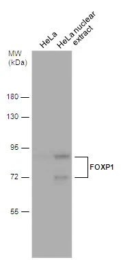 HeLa whole cell and nuclear extracts (30 μg) were separated by 7.5% SDS-PAGE, and the membrane was blotted with FOXP1 antibody (GTX129252) diluted at 1:500.