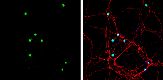 Neurogenin 2 antibody detects Neurogenin 2 protein by immunofluorescent analysis. Sample: DIV9 rat E18 primary hippocampal neuron cells were fixed in 4% paraformaldehyde at RT for 15 min. Green: Neurogenin 2 stained by Neurogenin 2 antibody (GTX129258) diluted at 1:500. Red: beta Tubulin 3/ Tuj1, stained by beta Tubulin 3/ Tuj1 antibody [GT11710] (GTX631836) diluted at 1:500. Blue: Fluoroshield with DAPI (GTX30920).