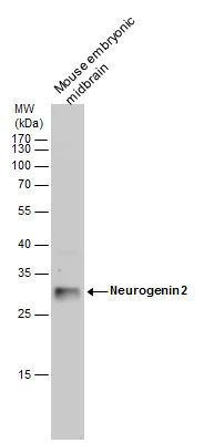 Neurogenin 2 antibody detects Neurogenin 2 protein by western blot analysis. Mouse tissue extracts (50 μg) was separated by 12 % SDS-PAGE, and the membrane was blotted with Neurogenin 2 antibody (GTX129258) diluted by 1:2000.