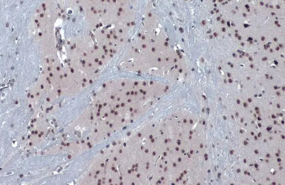 PERK antibody detects PERK protein at nucleus by immunohistochemical analysis. Sample: Paraffin-embedded mouse brain. PERK stained by PERK antibody (GTX129275) diluted at 1:500. Antigen Retrieval: Citrate buffer, pH 6.0, 15 min