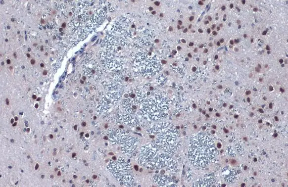 PERK antibody detects PERK protein at nucleus by immunohistochemical analysis. Sample: Paraffin-embedded rat brain. PERK stained by PERK antibody (GTX129275) diluted at 1:500. Antigen Retrieval: Citrate buffer, pH 6.0, 15 min