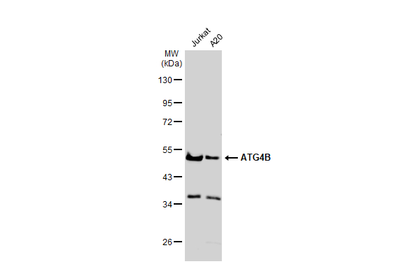 Various whole cell extracts (30 microg) were separated by 10% SDS-PAGE, and the membrane was blotted with ATG4B antibody (GTX129276) diluted at 1:1000. The HRP-conjugated anti-rabbit IgG antibody (GTX213110-01) was used to detect the primary antibody.